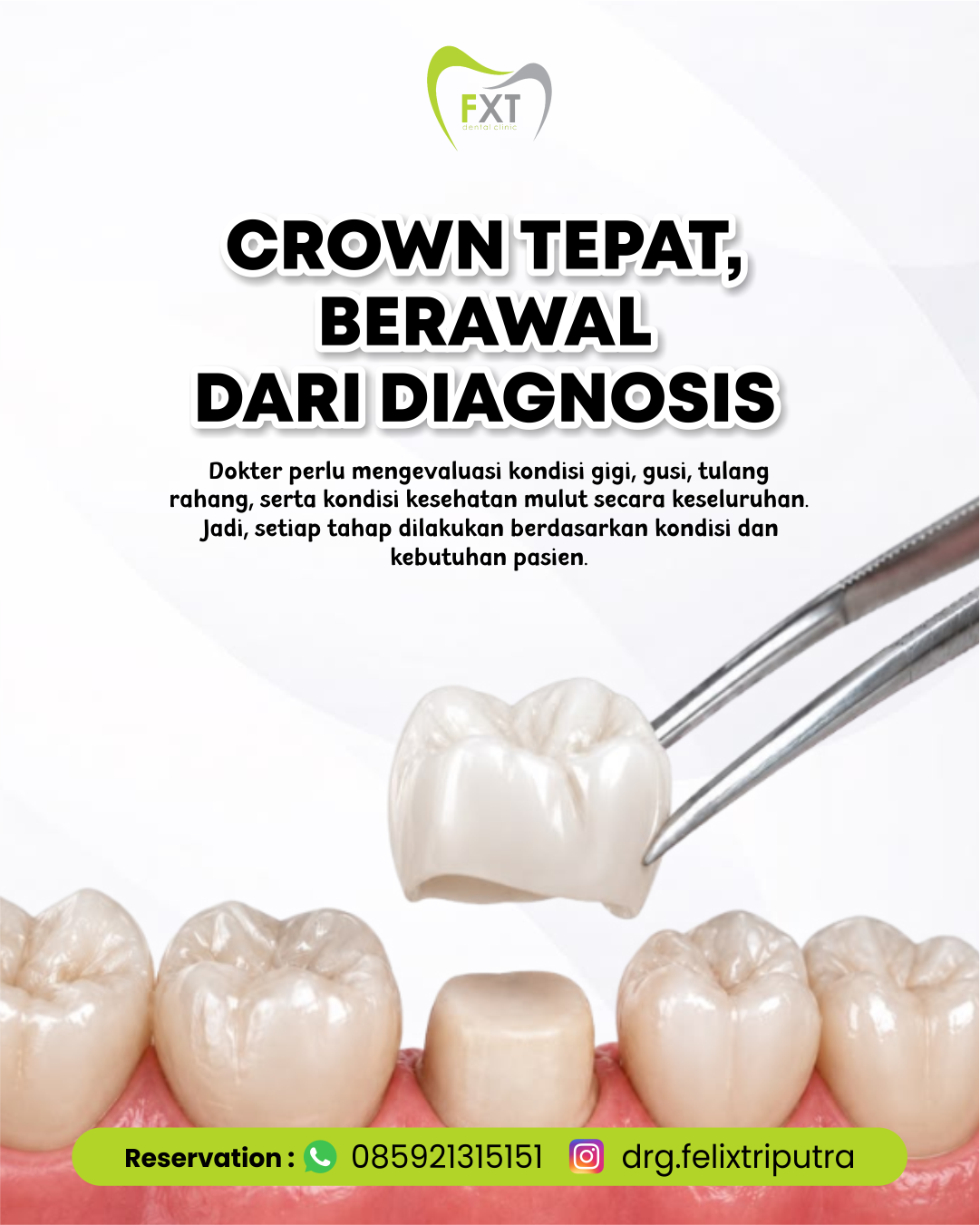 Crown Tepat Berawal Dari Diagnosis