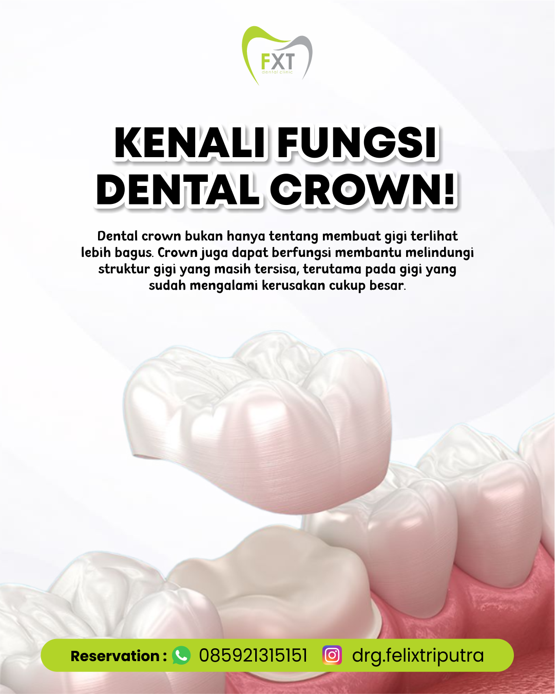 Kenali Fungsi Dental Crown!