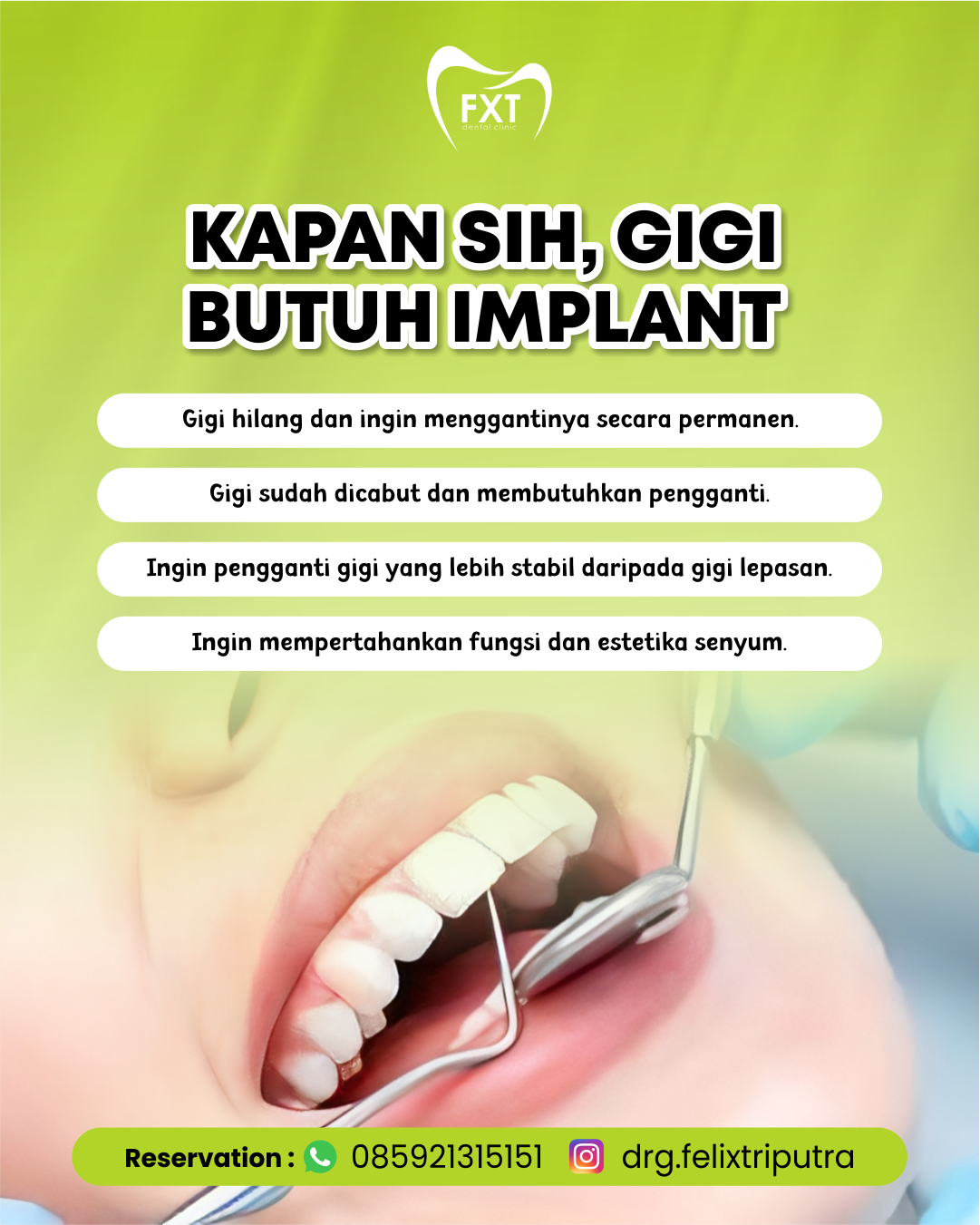 Kapan Sih, Gigi Butuh Implant?