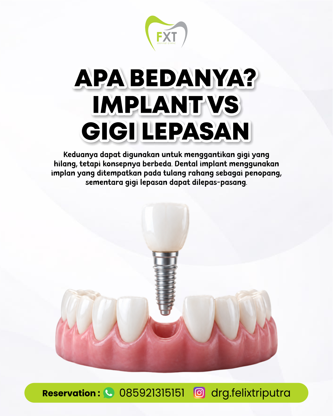 Apa Bedanya? Implant VS Gigi Lepasan