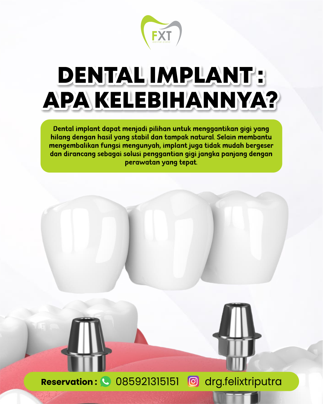 Dental Implant: Apa Kelebihannya?